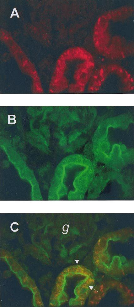 Indirect Immunofluorescence Confocal Micrographs Of Dmt Localization