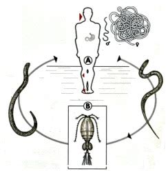 Introduction to Medical Parasitology: Guinea Worm