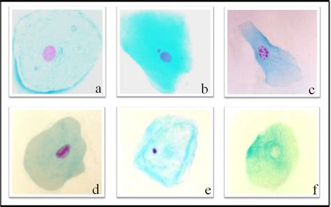 Figure From The Use Of The Micronucleus Test To Monitor Individuals