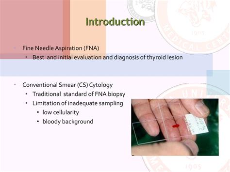 Ppt Liquid Based Cytology For Thyroid Fine Needle Aspiration