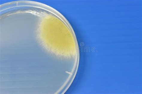 Bacteria Growth On Plate Count Agar Stock Photo Image Of Tobago