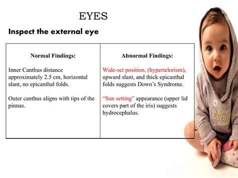 Infant Physical Assessment