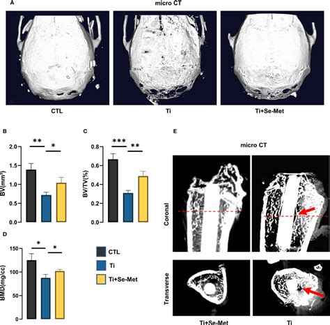 Frontiers Selenomethionine Against Titanium Particle Induced