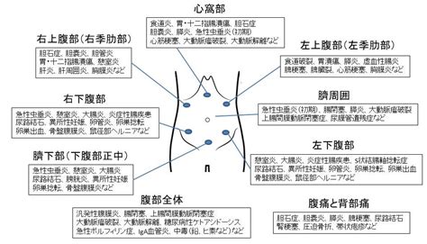 1 腹痛の原因となる病気は急にお腹が痛くなったら一般の方へ日本臨床外科学会