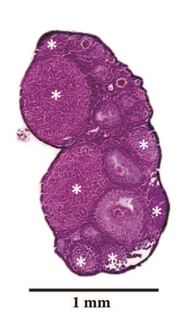 Quantification of corpora lutea number (CL) by H&E staining. Mother: M ...