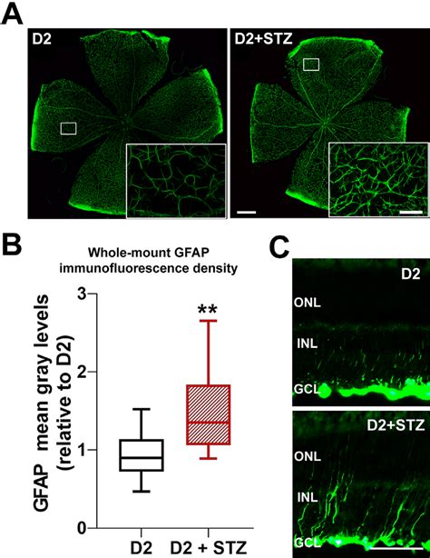 Gfap Immunostaining In Whole Mount Retinas And Retinal Cross Sections