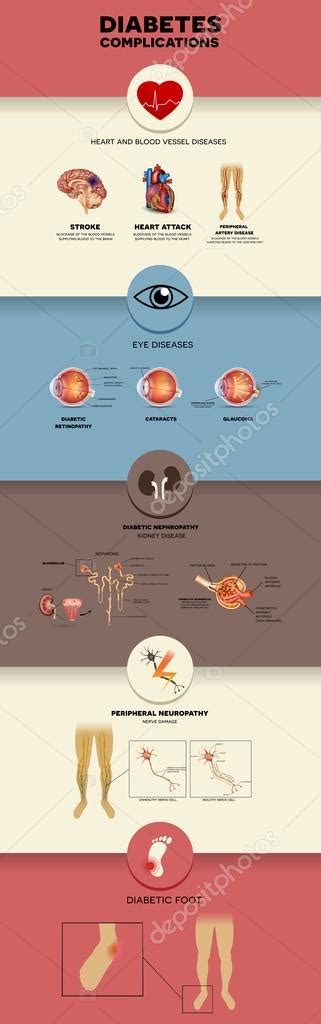 Gráfico De Información De Diabetes Mellitus 2023