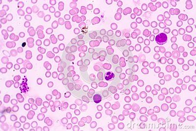 White Blood Cells Are The Cells Of The Immune System Under The ...