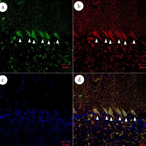 Double staining co-localizes on Purkinje cells infected with A.... | Download Scientific Diagram