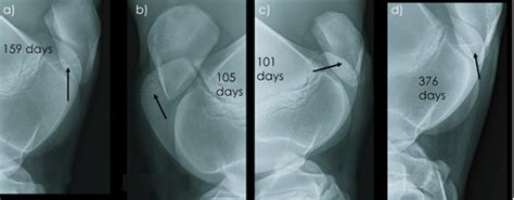 Stifle Radiography In Thoroughbreds From 6 To 18 Months Of Age