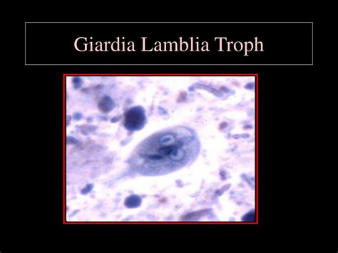 Ppt Intestinal Protozoa Giardia And Balantidium Trichomonas Vaginalis Powerpoint Presentation