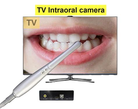 Highly Recommended TV Intraoral Camera VGA AV Dental Camera China TV