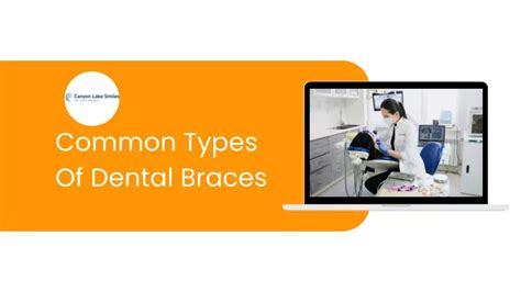 Ppt Common Types Of Dental Braces Powerpoint Presentation Free Download Id 11895737