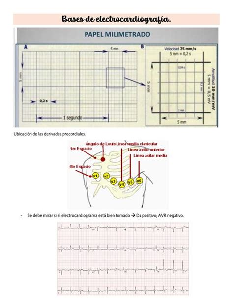 Bases De Electrocardiografia Ritmo Medico UDocz