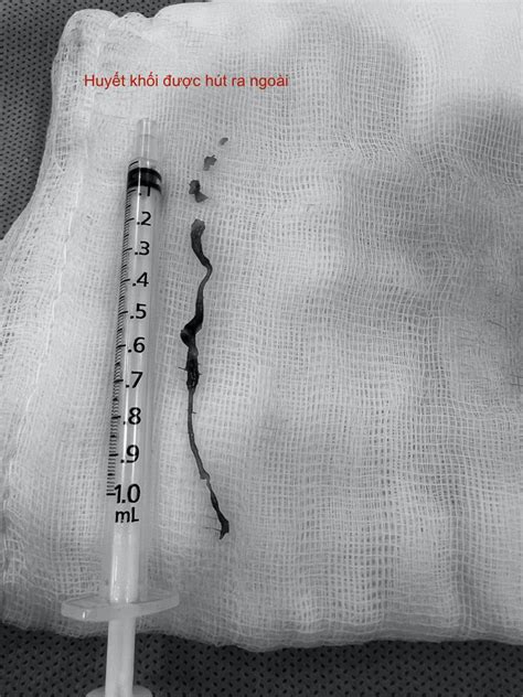 Tin Nh C Nh Ti M R A Xe C G I M C Bikini Ch P H Nh G Y Ph N C M Kh Ng Kh L Nh Ang