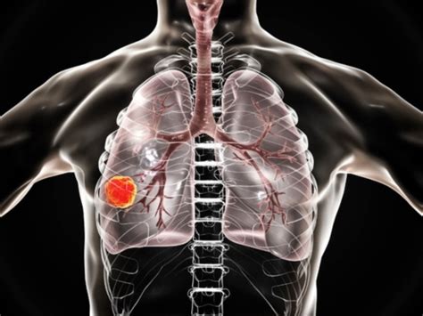 Respiratory Function Testing Rsdc