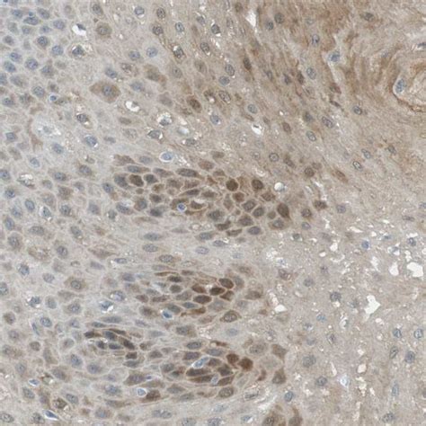 Rabbit Polyclonal Anti Serpinb2 Antibody Buy For Research Highly