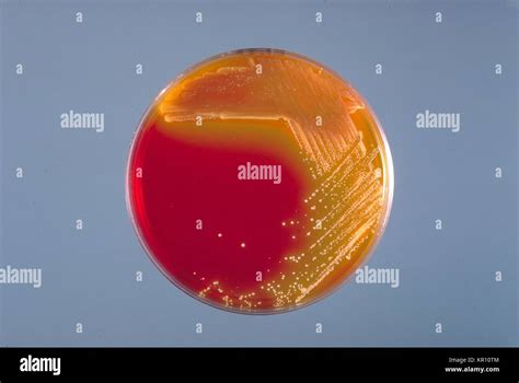 This Is A Xylose Lysine Deoxycholate Xld Agar Culture Plate That