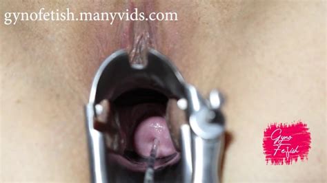 Cervix Biopsy Insemination Medical Gyno Fetish Doctor Exam Speculum