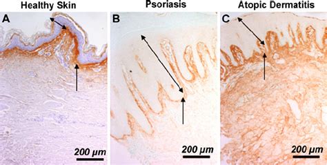 Immunohistochemical Detection Of Periostin In Human Skin Samples