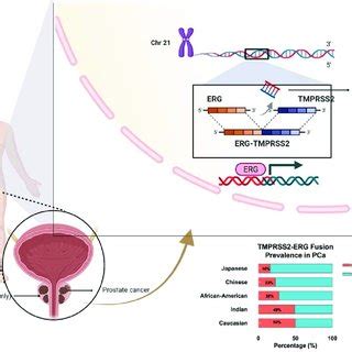 Schematic Diagram Of Tmprss Erg Gene Fusion On Chromosome And The