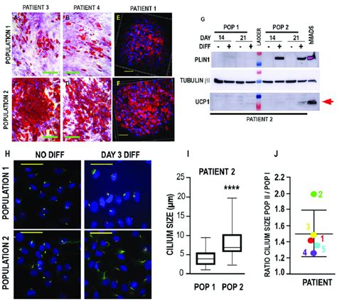 Adipose Differentiation Of The Two Breast Adipose Progenitor Cell Apc