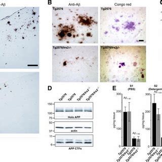 Deletion of Irs2 reduces Aβ deposition and decreases insoluble Aβ A