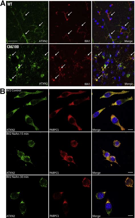 Microglia Is Affected By Atxn Aggregates In Spinal Cord And By