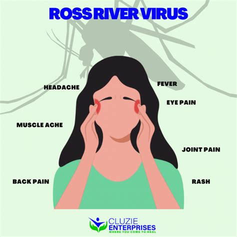 Ross River Virus - Cluzie