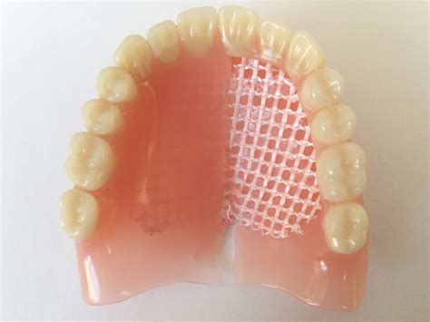 Dentapreg Dentures