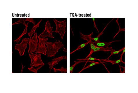 Acetyl Histone H3 Antibody Sampler Kit Cell Signaling Technology