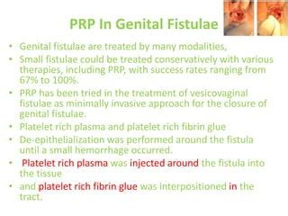 Platelet Rich Plasma Urogynecology PPT