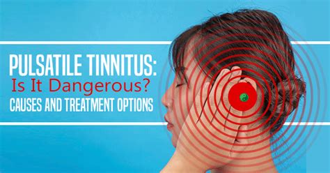 Pulsatile Tinnitus Philadelphia Holistic Clinic Treatment By Dr Tsan