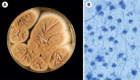 Morphological Features Observed On Sabouraud Dextrose Agar After 7 Days