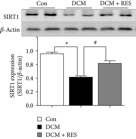 Resveratrol Alleviated Cardiac Dysfunction In DCM Mouse Heart A