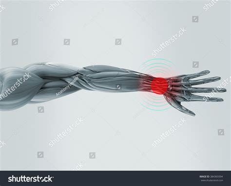 Anatomy Model Illustration Wrist Pain Stock Illustration 384369394 | Shutterstock