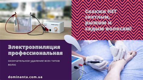 Электроэпиляция профессиональная - YouTube