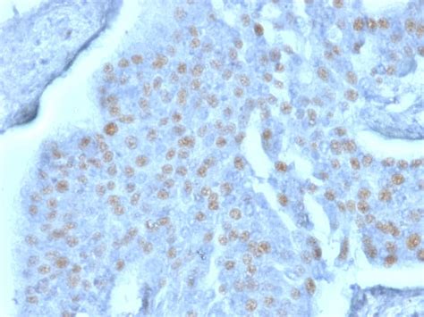 Dbpa Antibody Pcrp Ybx D Azide And Bsa Free Nbp Novus