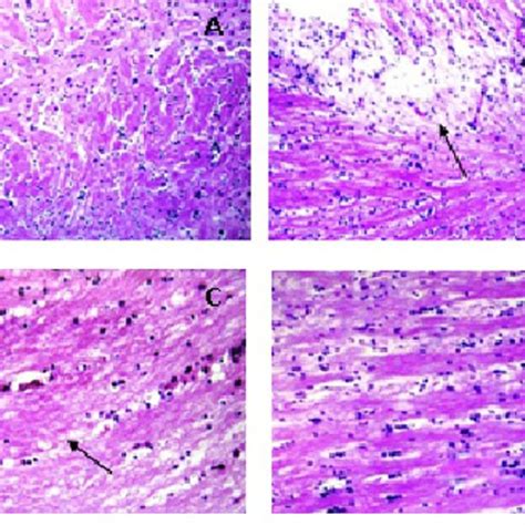 Photomicrographs For Striatal Sections Of A Control B And C Rotenone