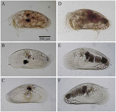 Ostracoda Slide