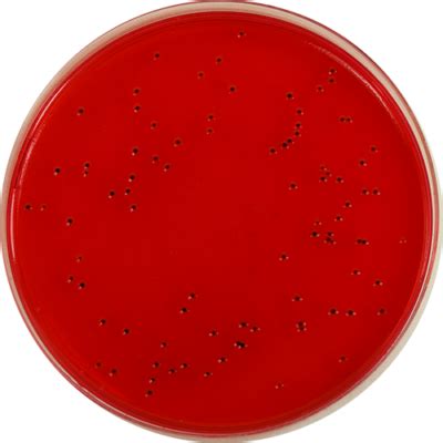 Xylose Lysine Deoxycholate Xld Agar With Novobiocin Mg L E