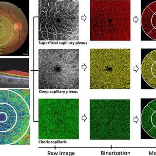 The Swept Source Optical Coherence Tomographic Angiography Provides