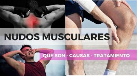 NUDOS Y CONTRACTURAS MUSCULARES Qué son y qué los causa Nudos