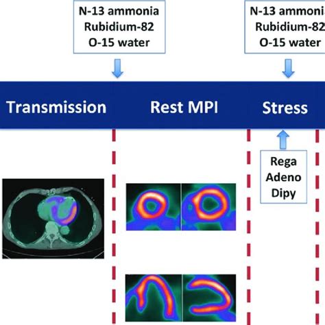 Rest M Tc Sestamibi Spect Myocardial Perfusion And Rest