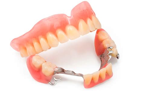 Бюгельные протезы для зубов на верхнюю и нижнюю челюсть