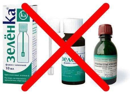 Чем мазать ветрянку у детей кроме зеленки: полный список лекарств