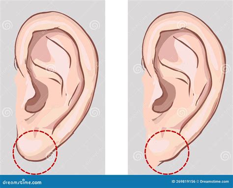 Free Earlobe And Attached Earlobe In Comparison Stock Illustration