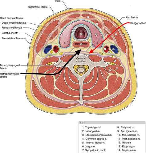 Retropharyngeal abscess - Pictures