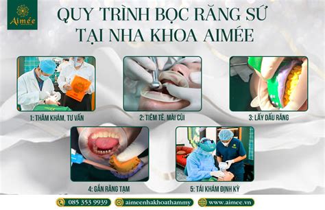 Quy TrÌnh BỌc RĂng SỨ MỸ KhÔng Kim LoẠi