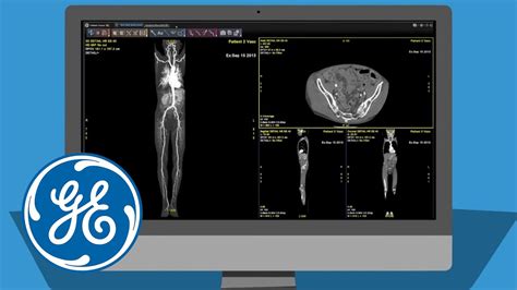 GE Healthcare AW VolumeShare 7 Advanced Visualisation Software GE